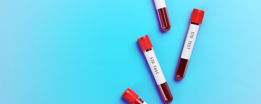 STI Awareness and the Importance of Regular Testing