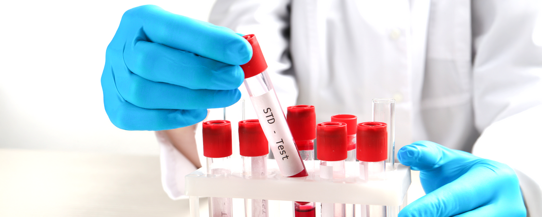 Testing for Sexually Transmitted Infections