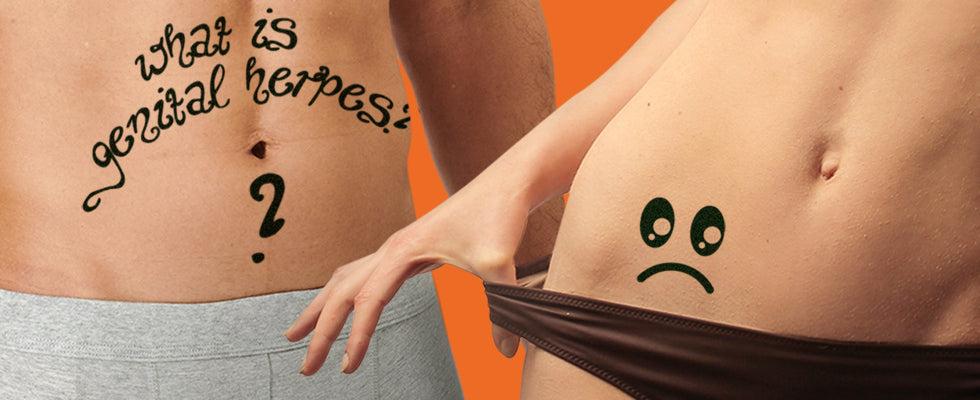 What are Genital Herpes?